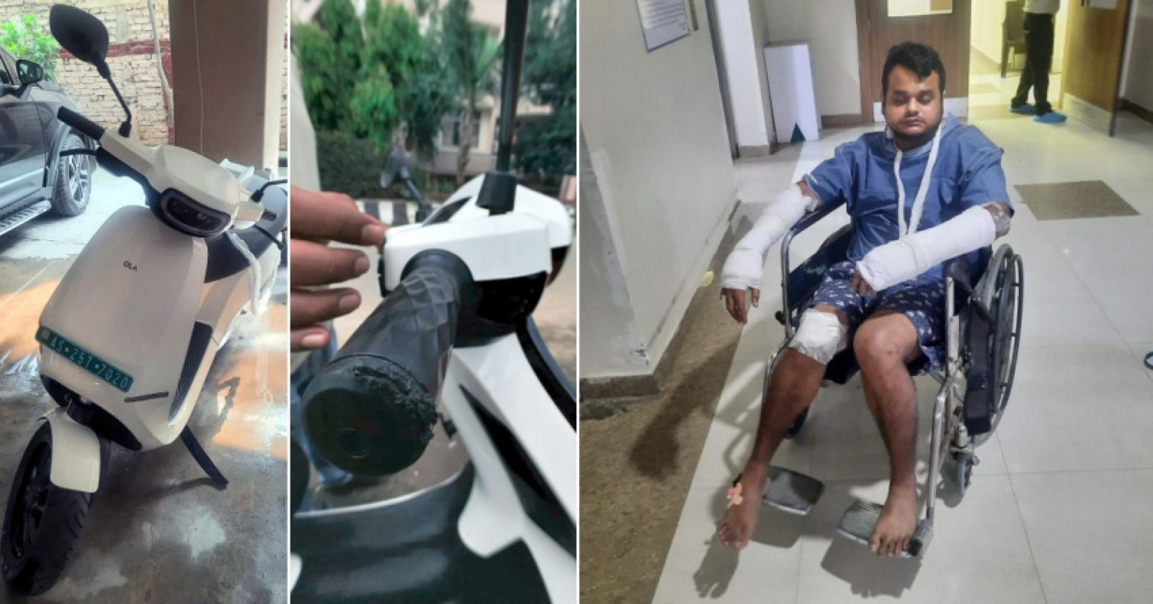 autos, cars, faulty ola s1 pro throws rider off on a speed breaker: 16 stitches, broken hand