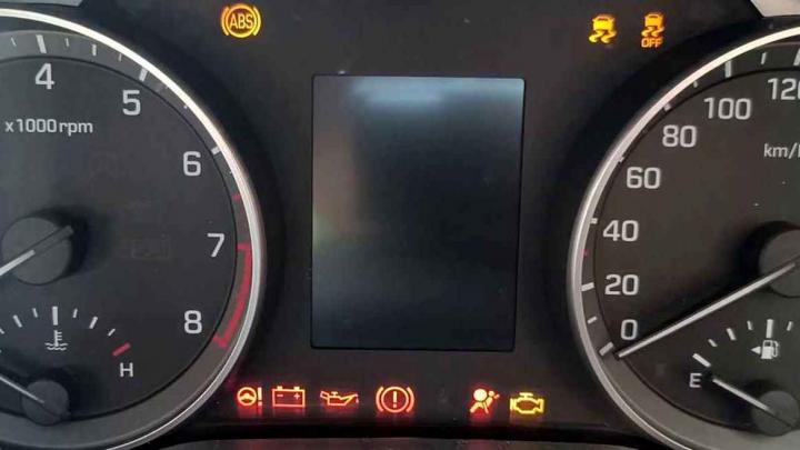 warning lights on my hyundai elantra flashed & the car failed to start